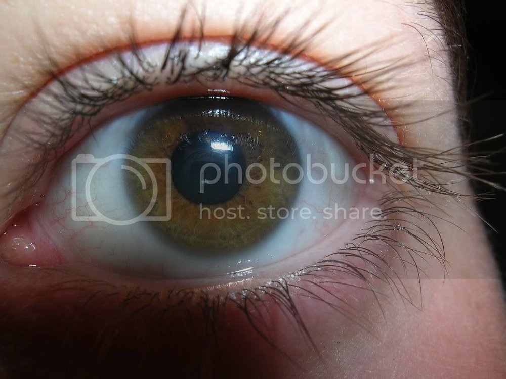 Eye.jpg