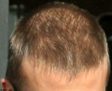 beckhambaldBIG_468x379.jpg
