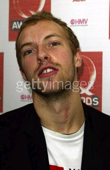 chris2.png