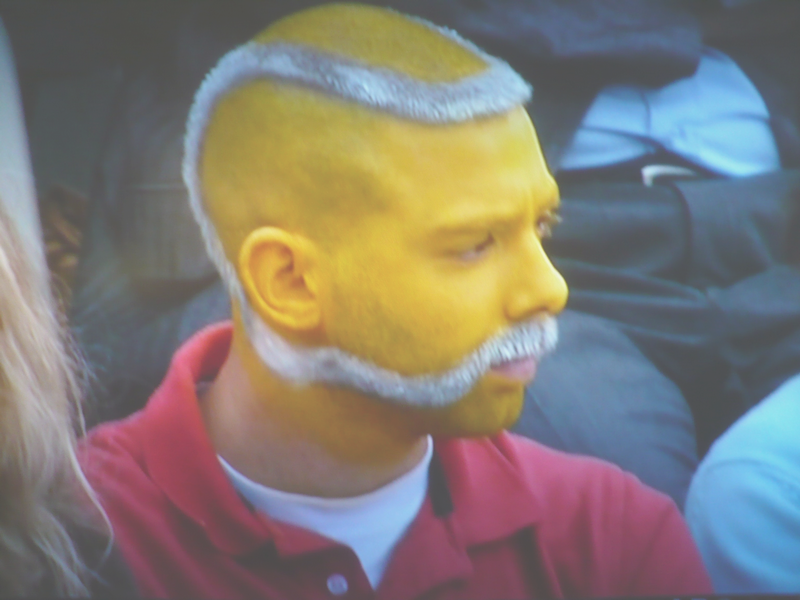 tennis+ball+hair+cut+-+innovative+or+weird.png?g2_GALLERYSID=25a84e588309afbfe00f9c8c4f8a1c87